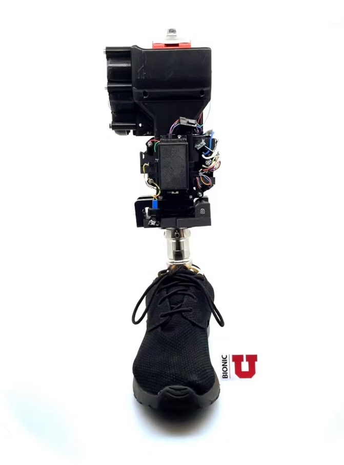 Ubuild Leg powered prosthesis